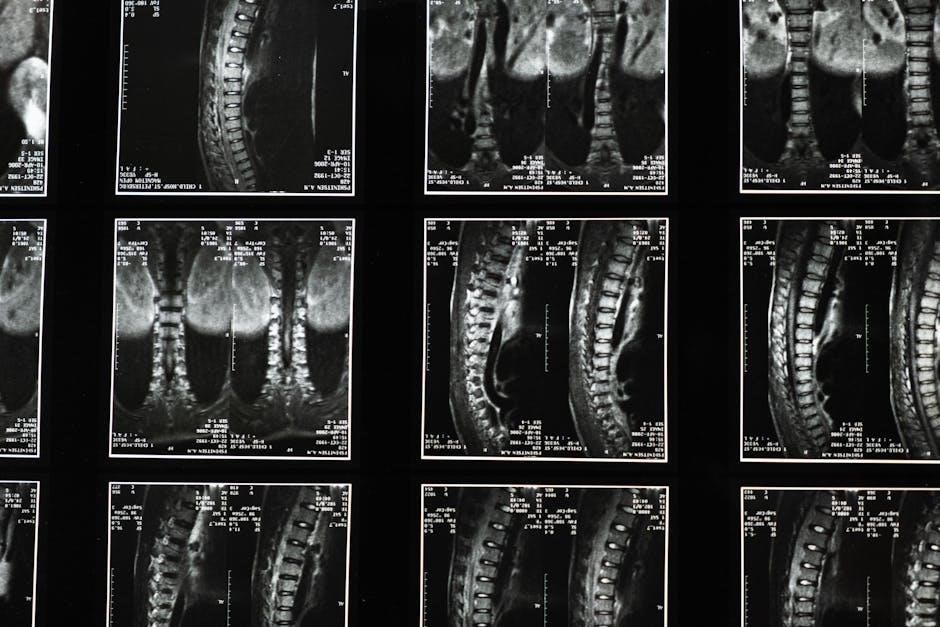 lumbar spinal stenosis exercises pdf